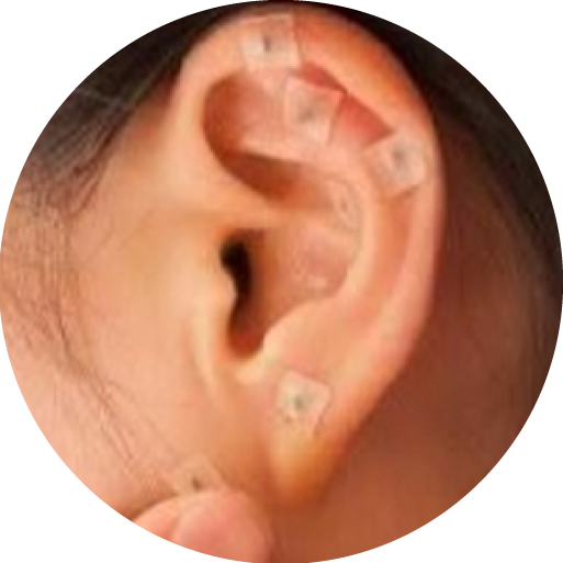 oreja
